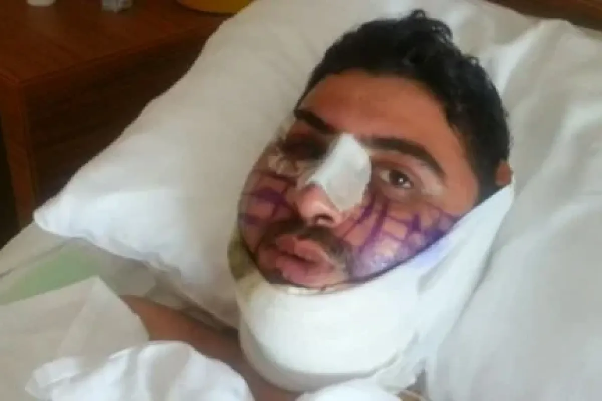 Üst Geçit Faciasını Anlattı
