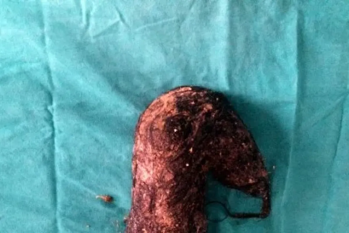 Doktorlar Bile Hayrete Düştü