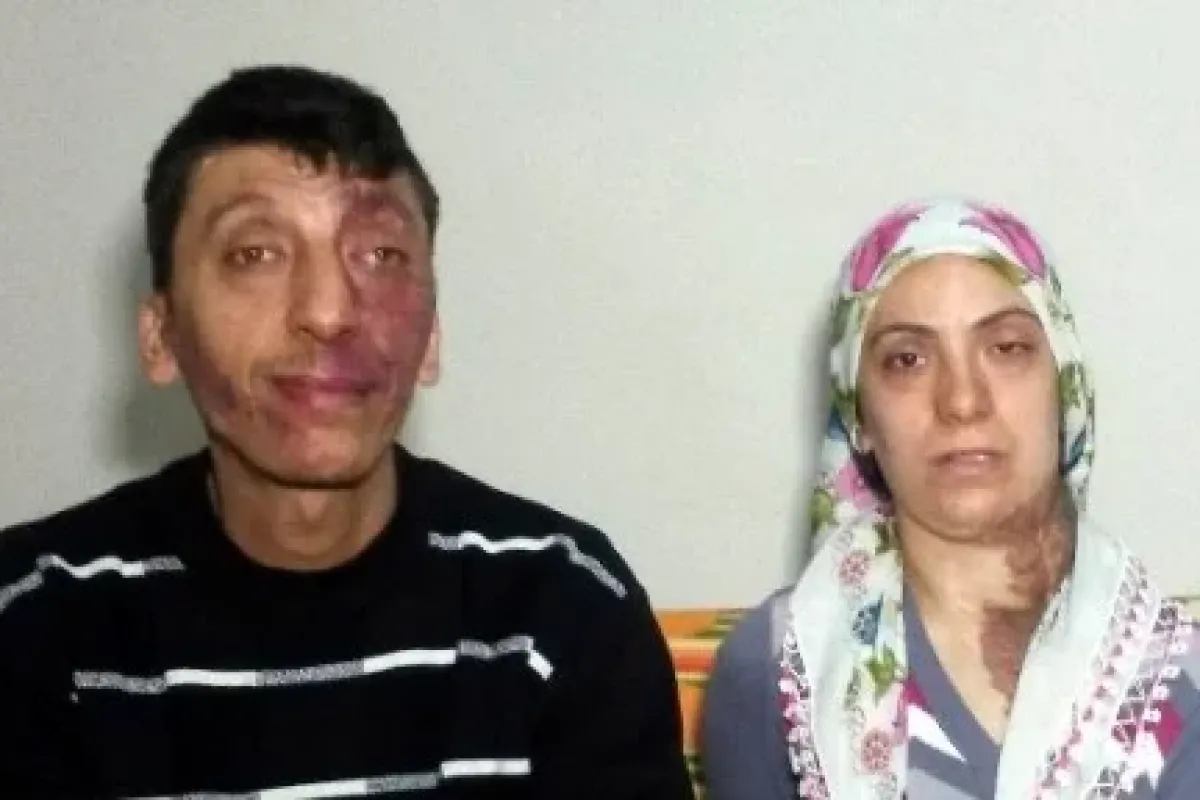 Tek Istekleri Tedavi Olmak