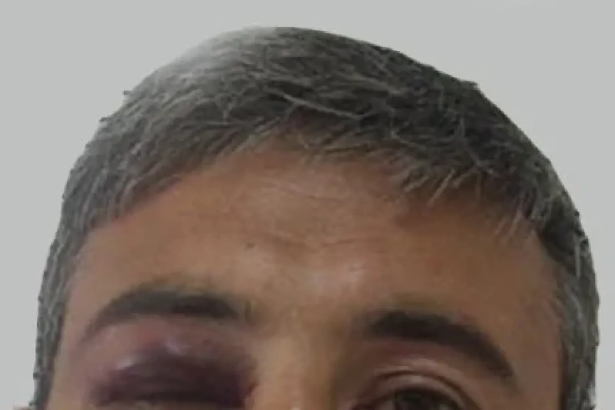 Televizyon Kavgası Cinayetle Bitti