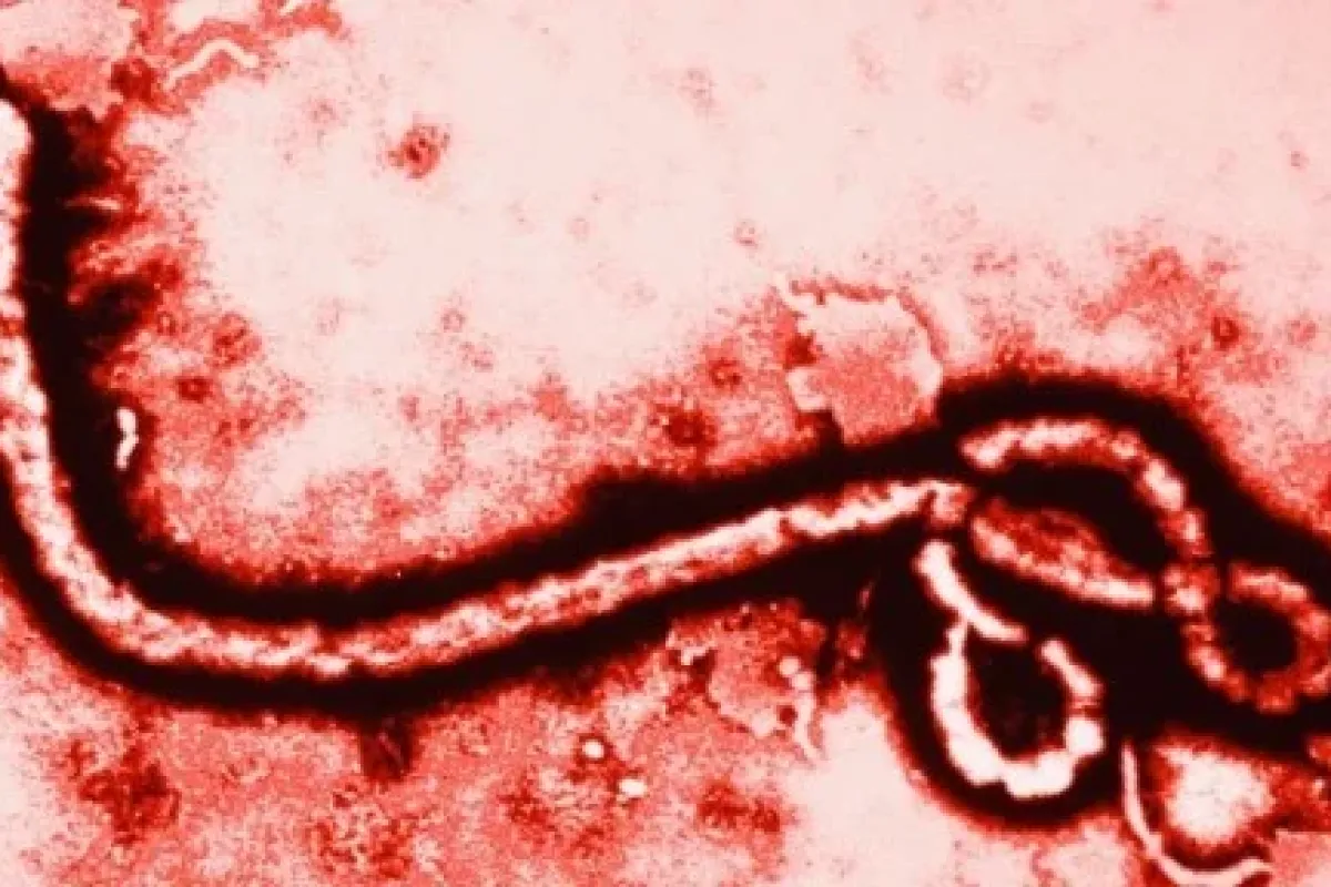 Ebola Kendini Grip Gibi Gösteriyor