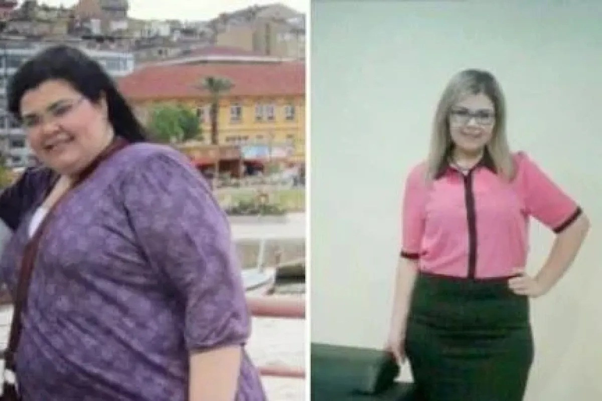 78 Kilo Verdi Hayatı Değişti