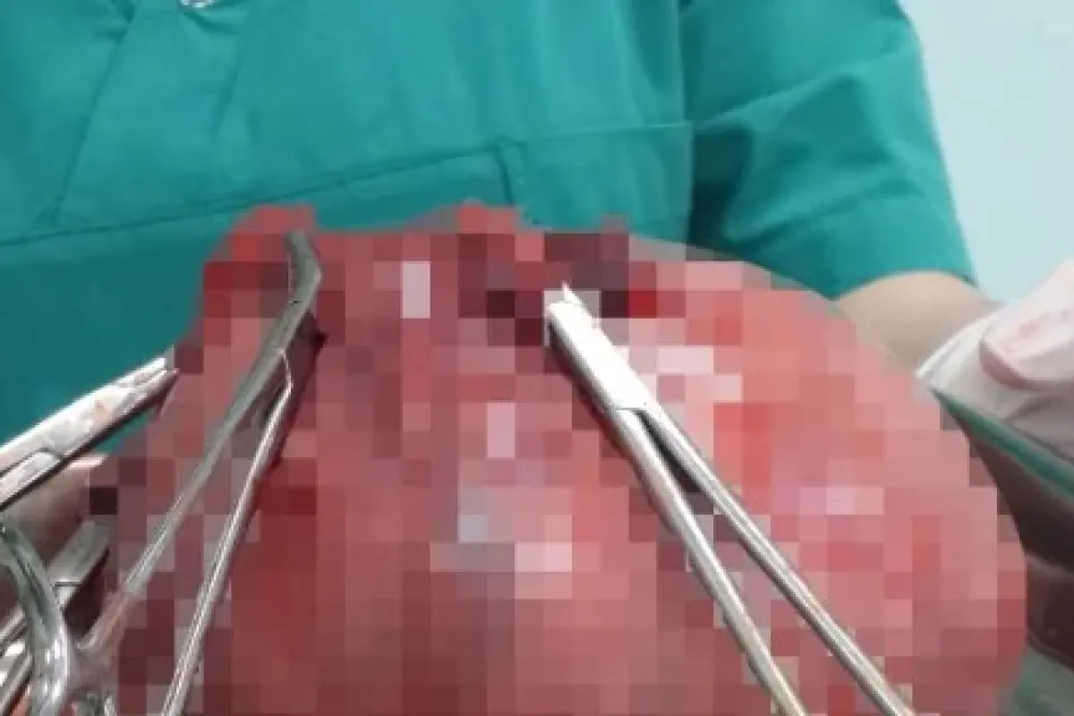 Doktorlar Bile şaşkına Döndü