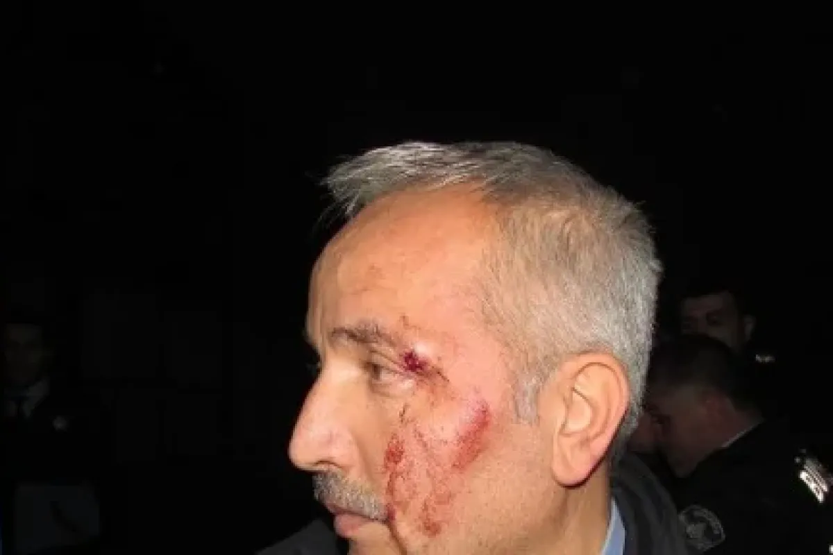 Zabıtaya levyeli saldırı