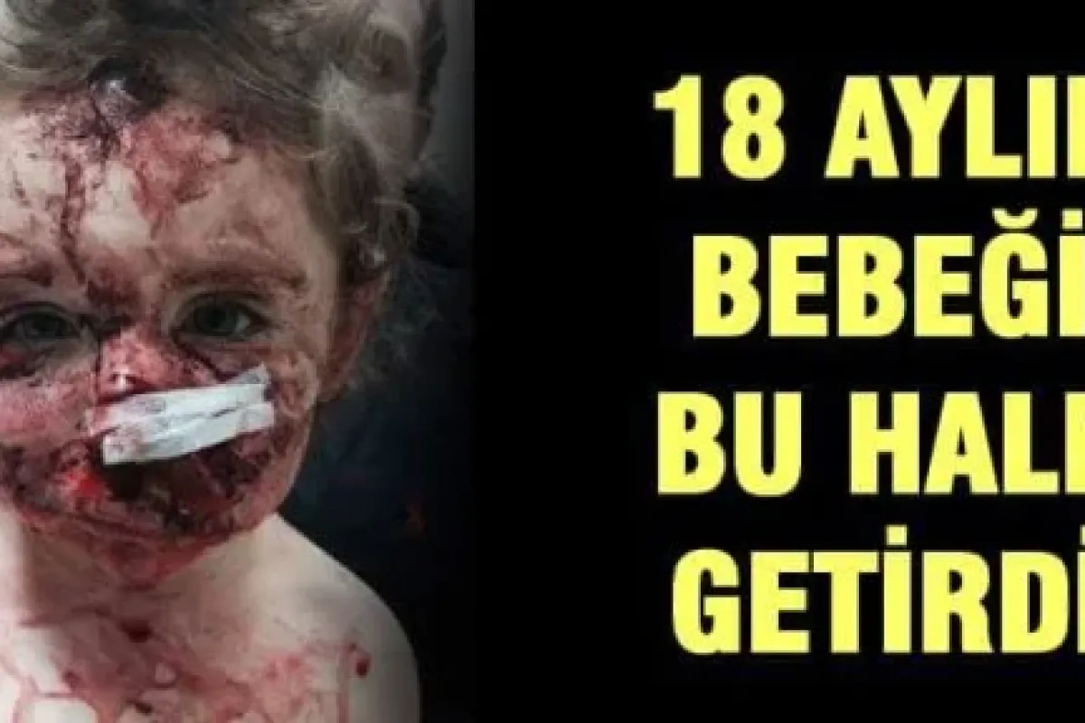 18 aylık bebegi bu hale getirdi!