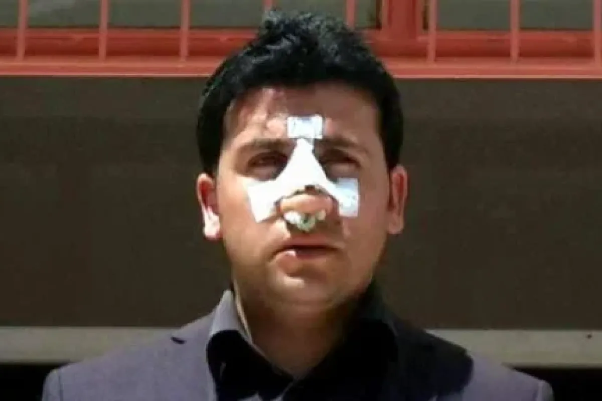 Öğretmeni hastanelik ettiler