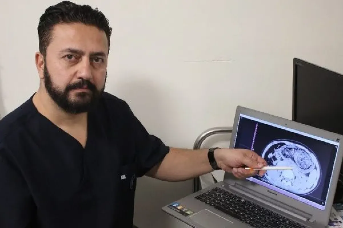 12 yaşındaki kızın midesinden top büyüklüğünde saç ve sakız yumağı çıkarıldı