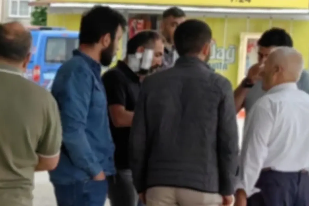 Yüzünde bardak kırdı!