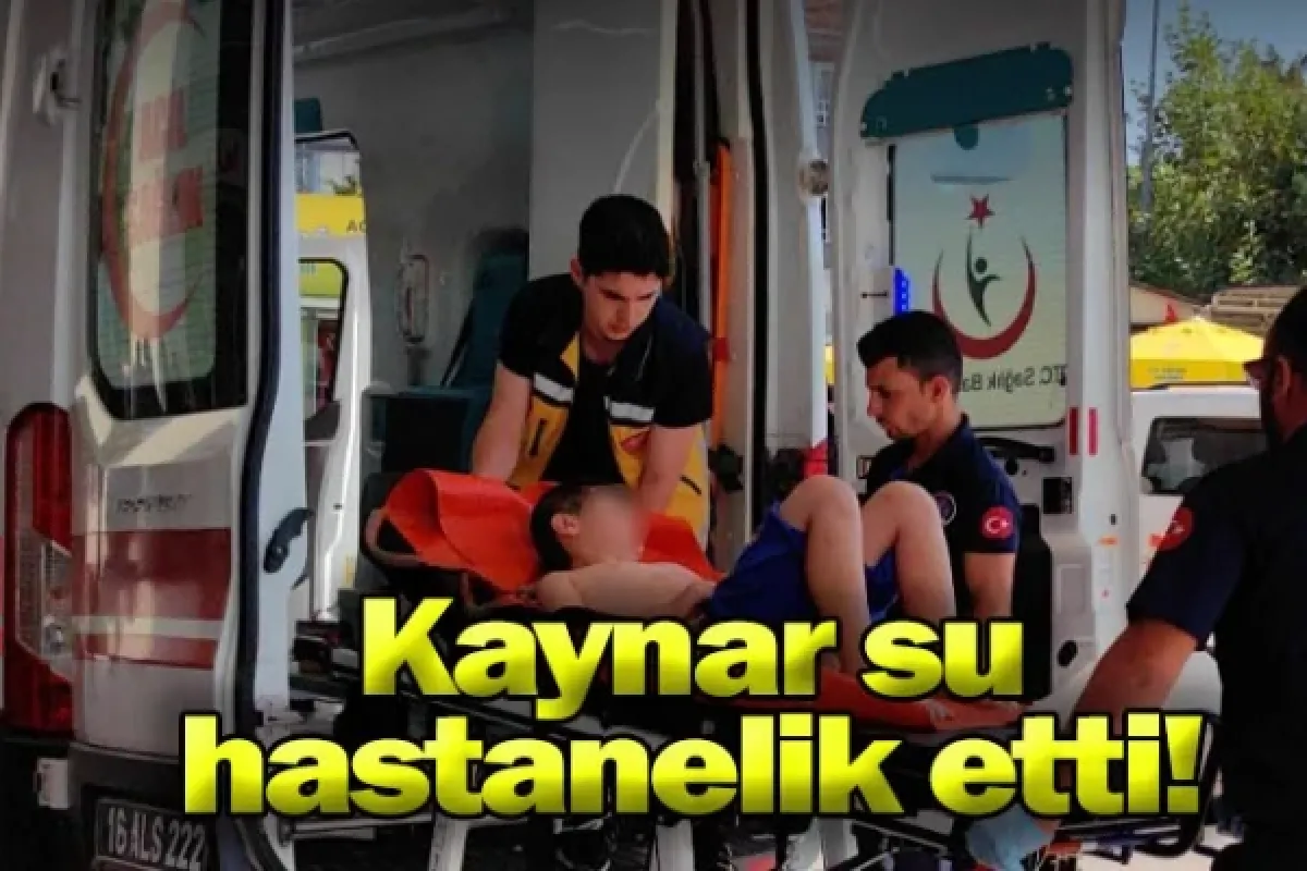 Kaynar su hastanelik etti