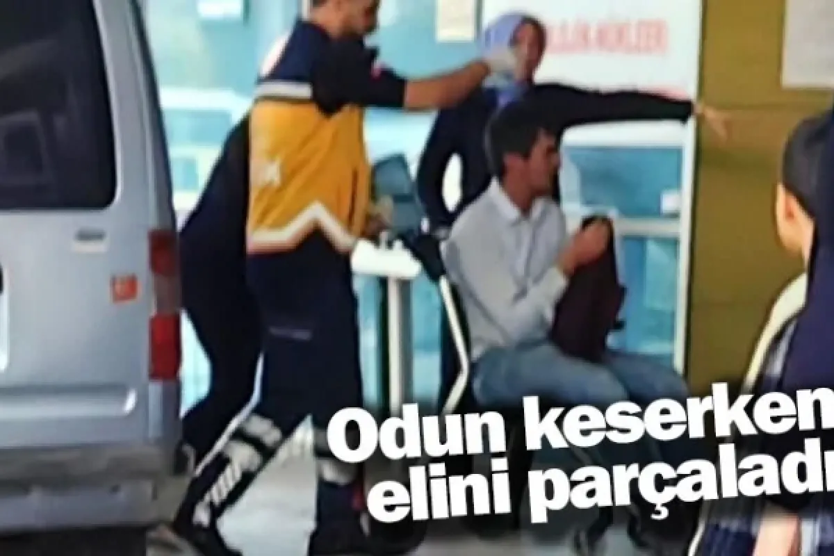 Odun keserken elini parçaladı