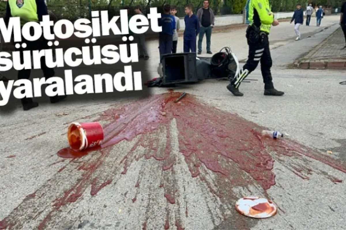 Motosiklet sürücüsü yaralandı