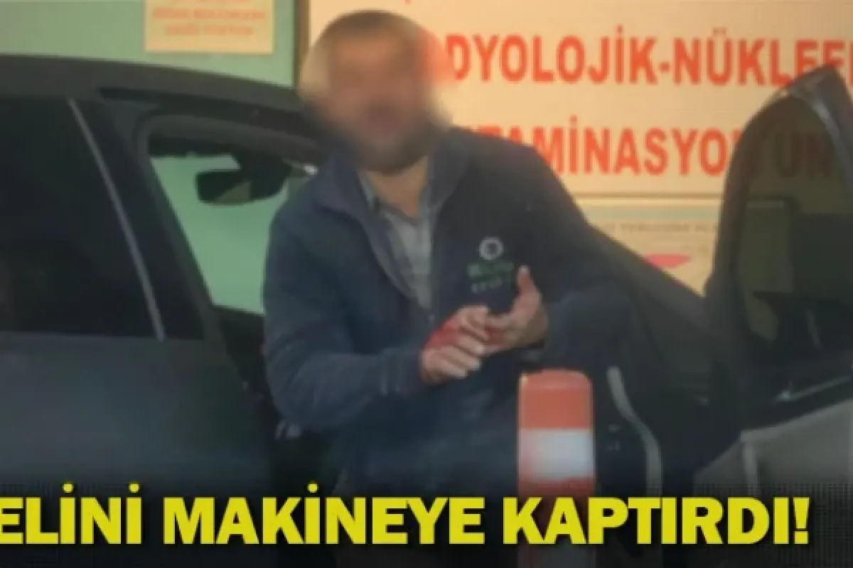 Elini makineye kaptırdı