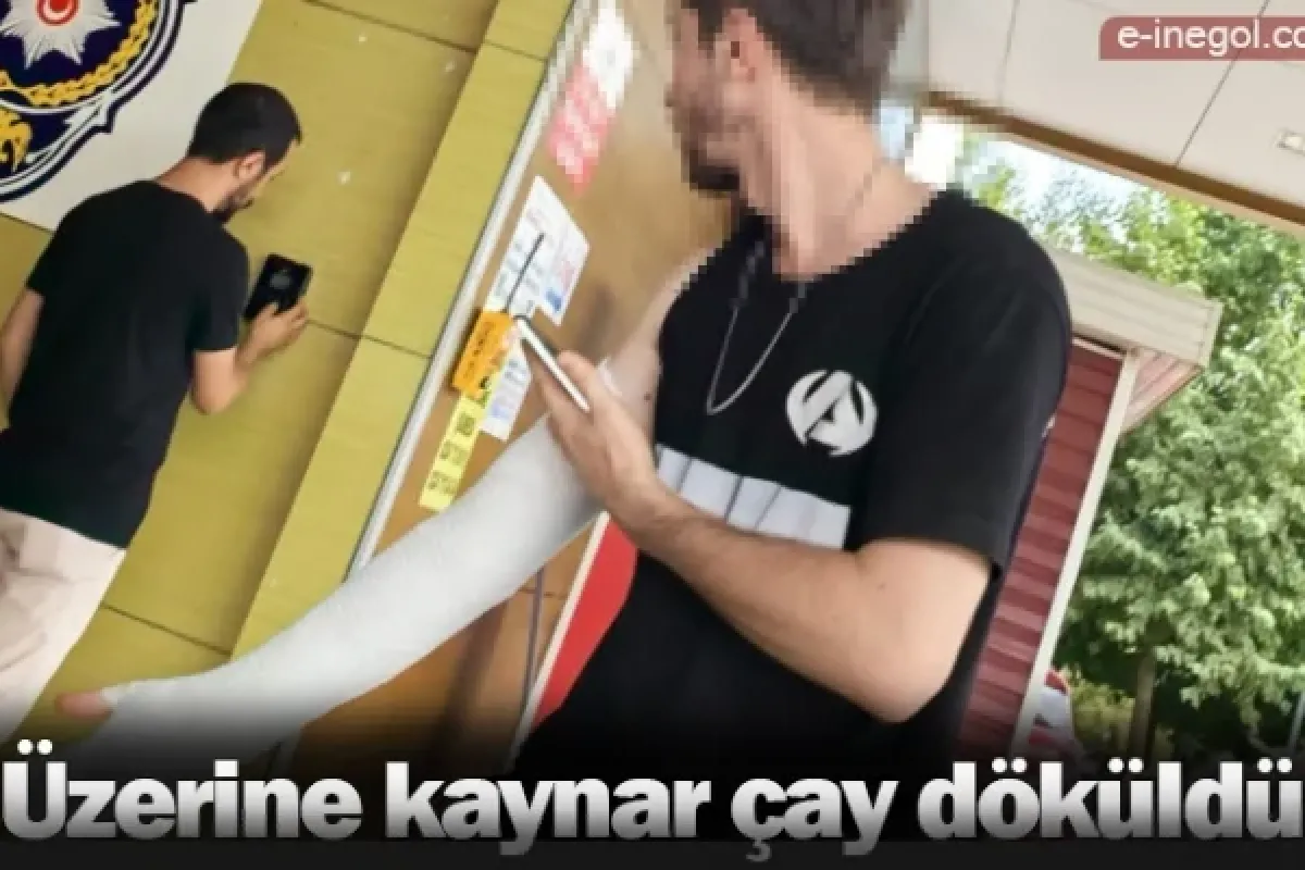 Üzerine kaynar çay döküldü