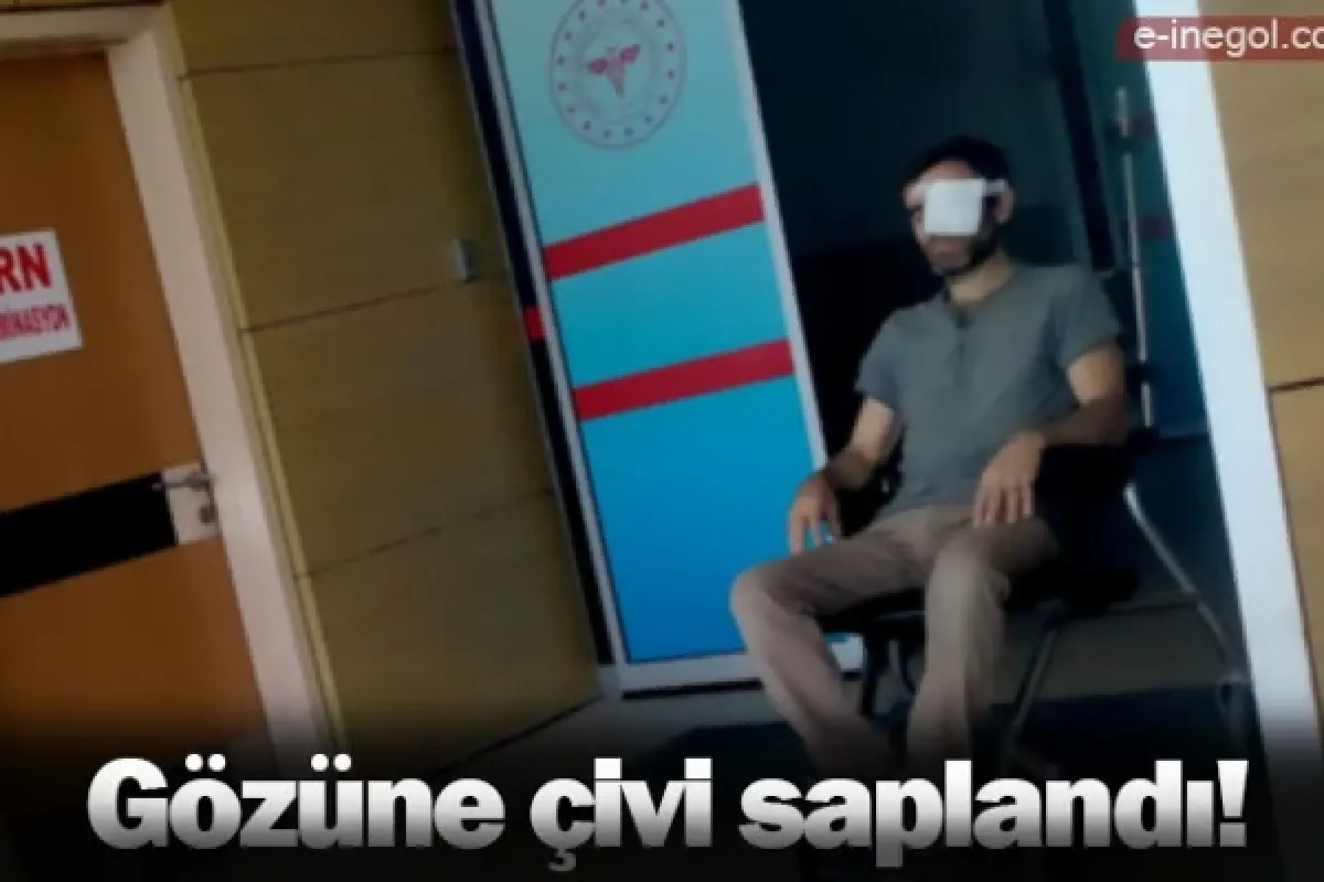 Gözüne çivi saplandı!