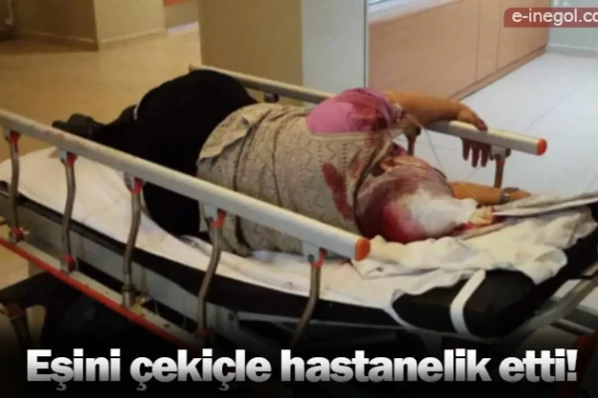 Eşini çekiçle hastanelik etti!