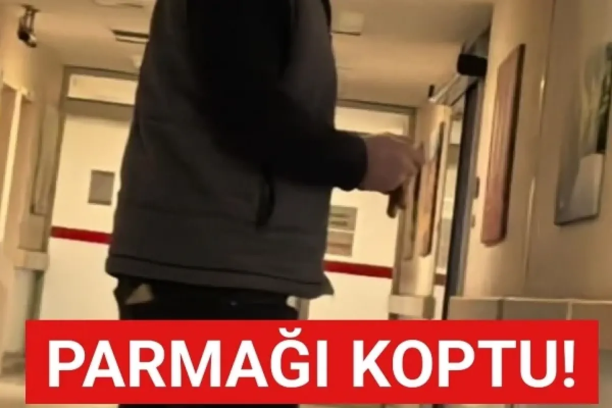 Parmağı koptu!