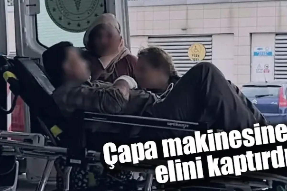 Çapa makinesine elini kaptırdı