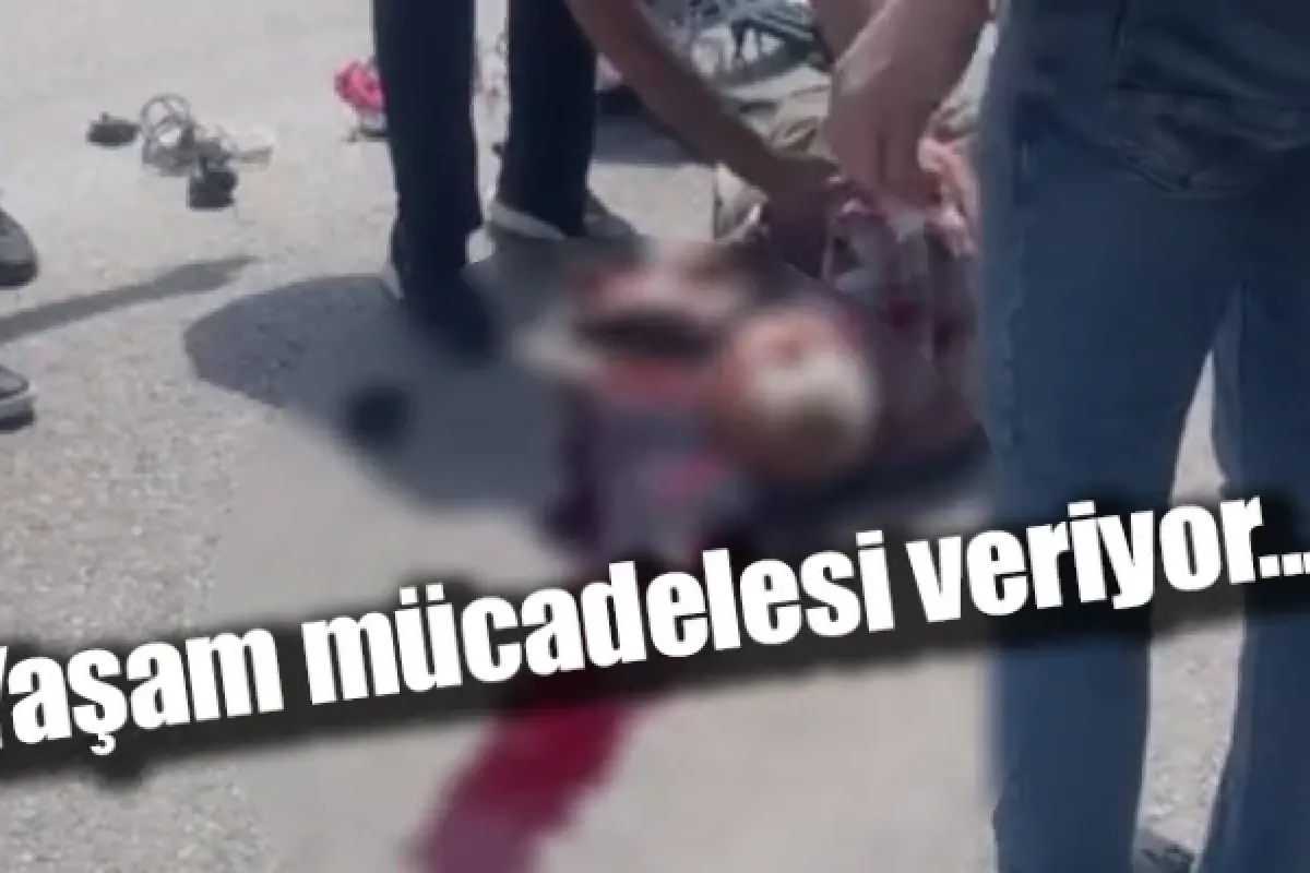 Yaşam mücadelesi veriyor...