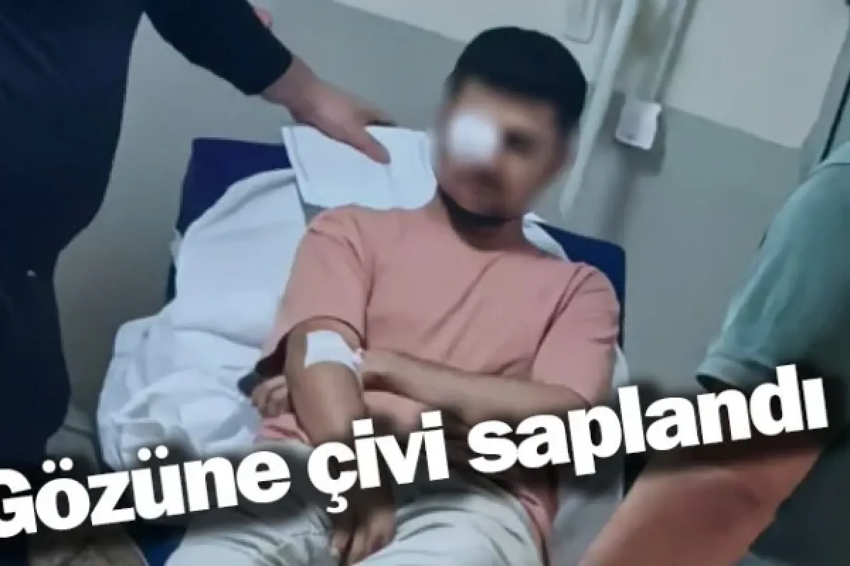 Gözüne çivi saplandı