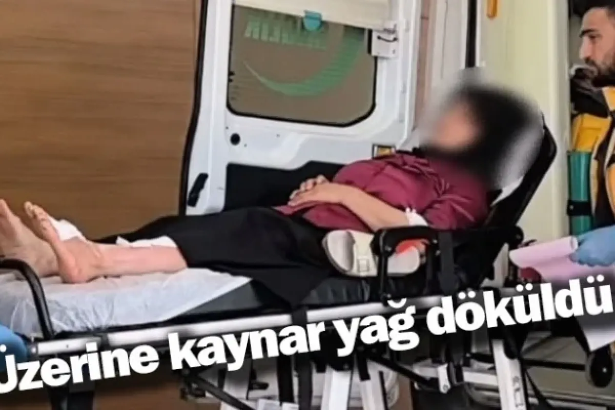 Üzerine kaynar yağ döküldü 