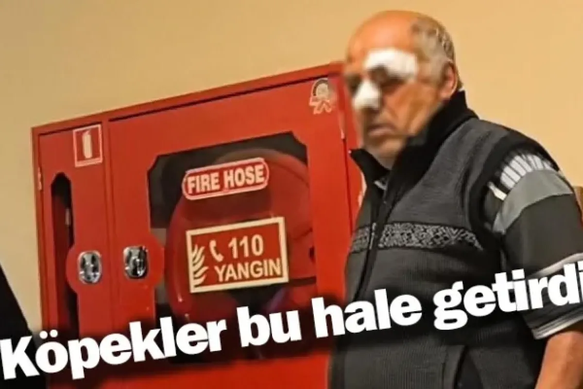 Köpekler bu hale getirdi