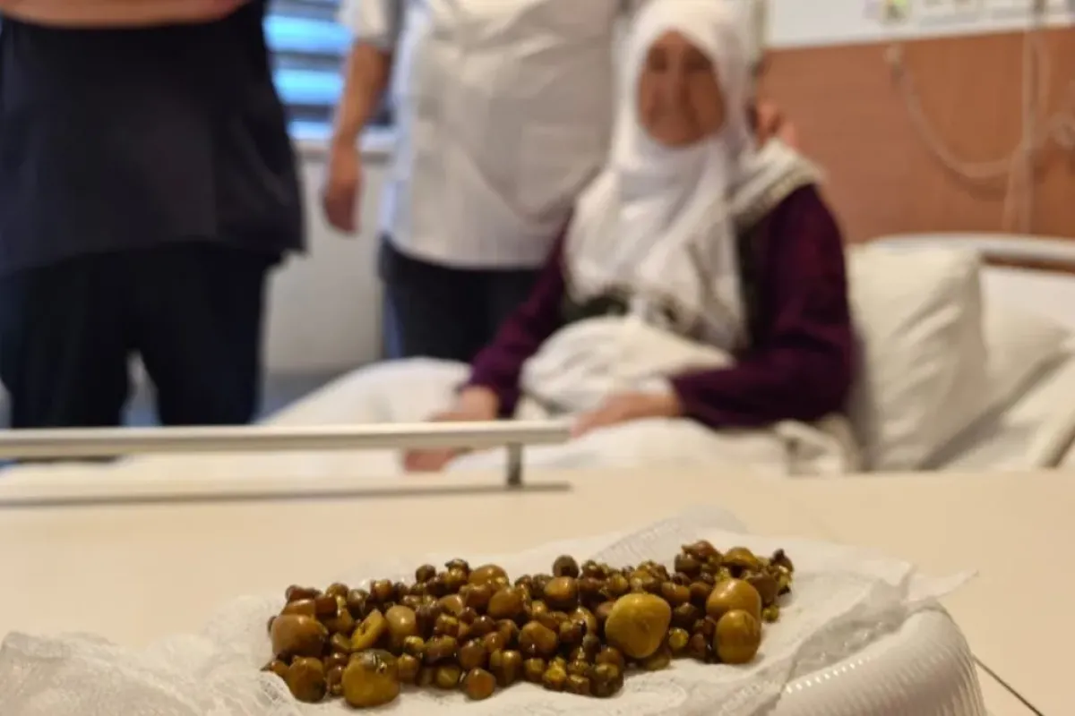 Safra kesesinden çıkanlar şoke etti!