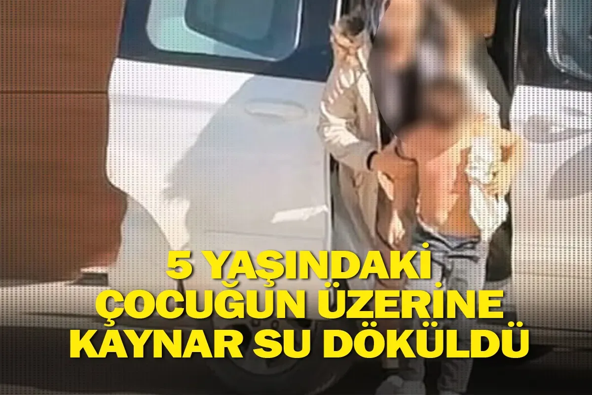 5 yaşındaki çocuğun üzerine kaynar su döküldü