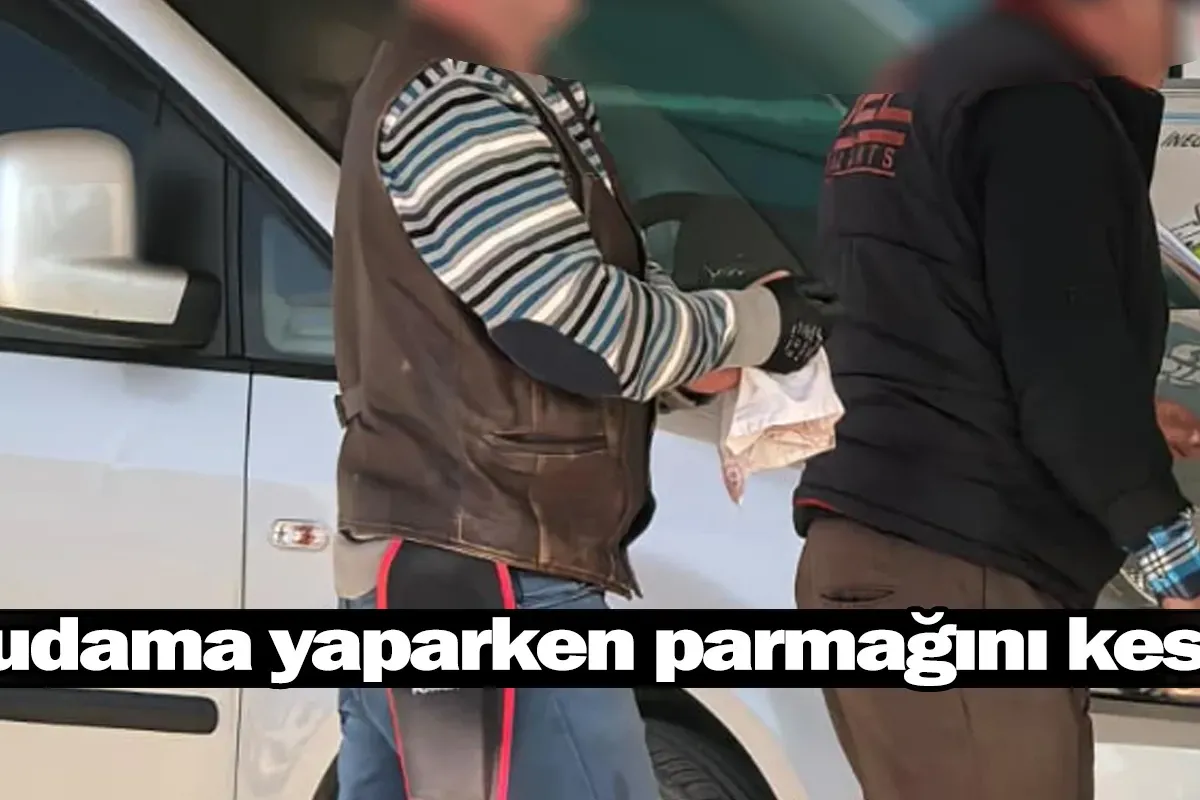 Budama yaparken parmağını kesti!