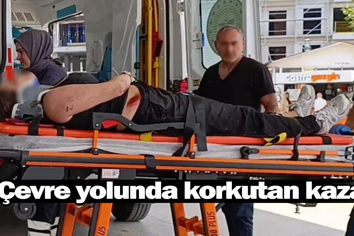 Çevre yolunda korkutan kaza