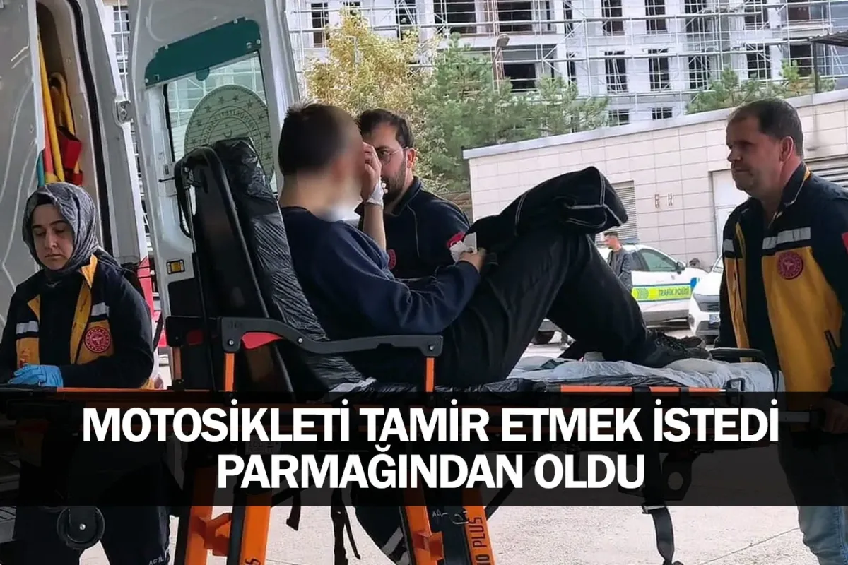 Motosikleti Tamir Etmek İstedi, Parmağından Oldu