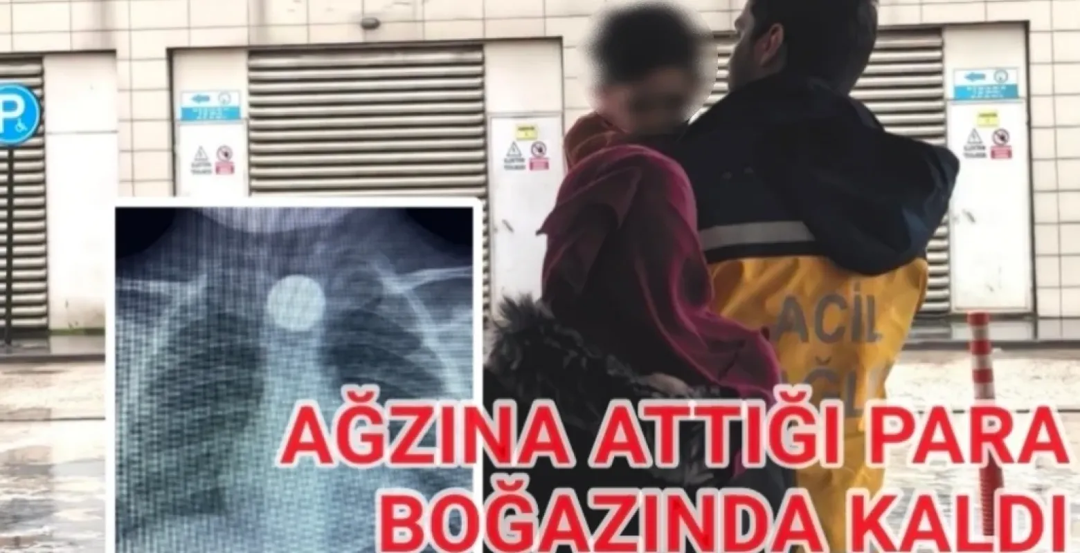 İnegöl'de ağzına attığı para boğazında kaldı