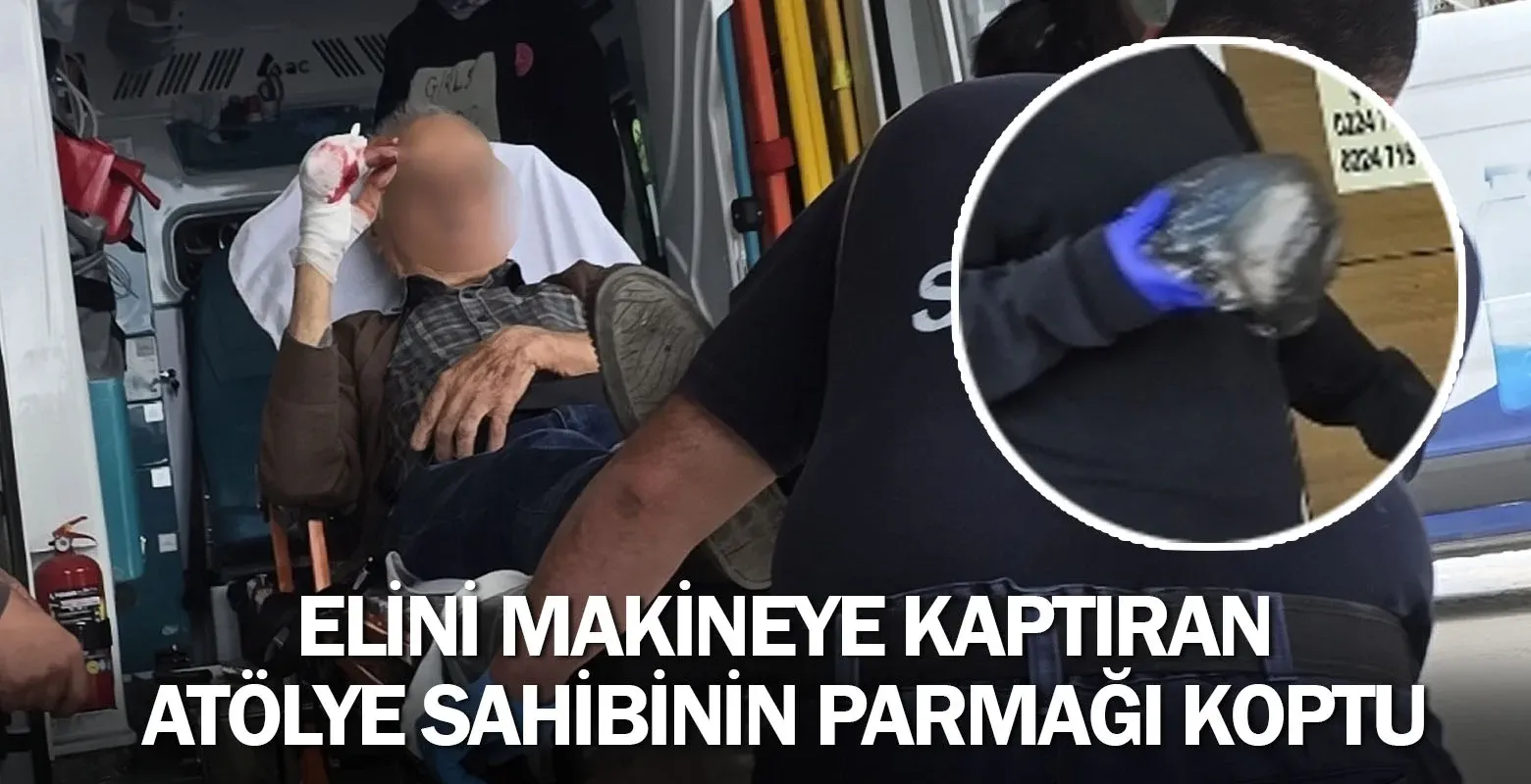 Elini makineye kaptıran atölye sahibinin parmağı koptu