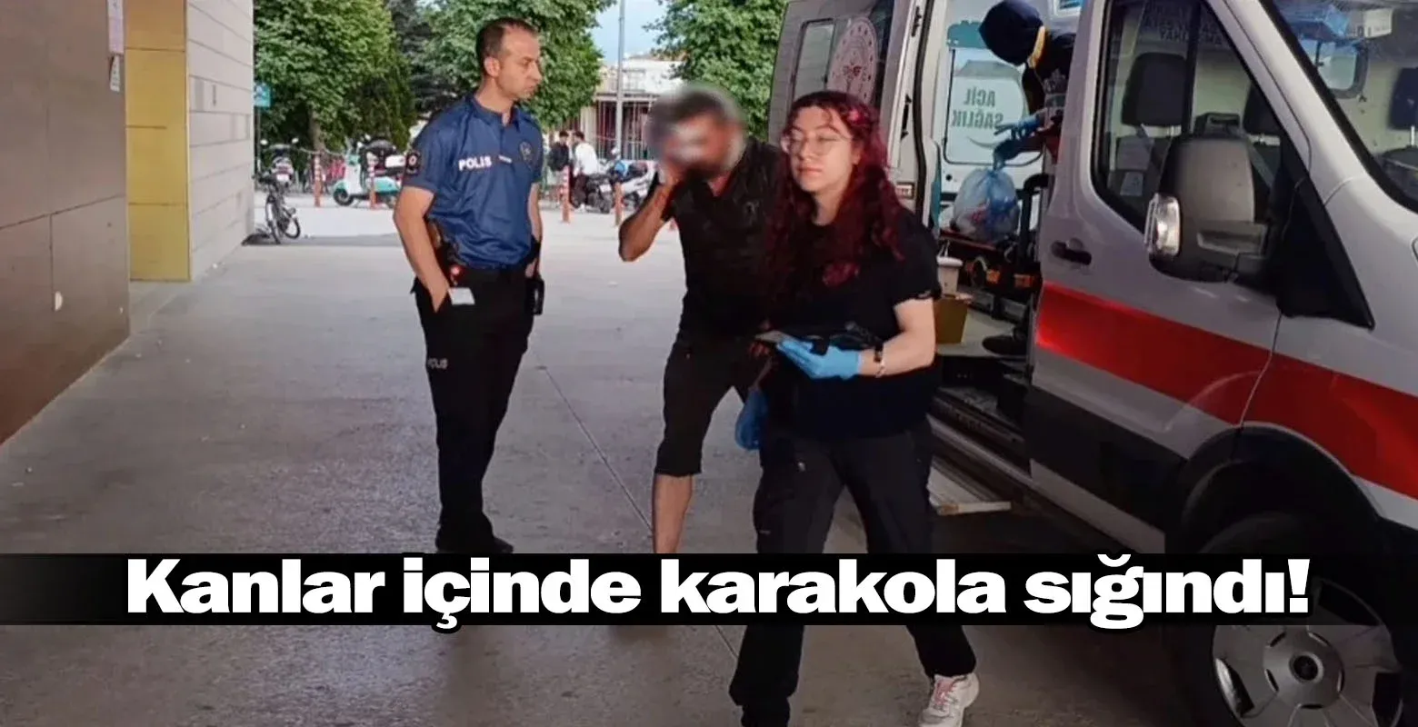 Kanlar içinde karakola sığındı!