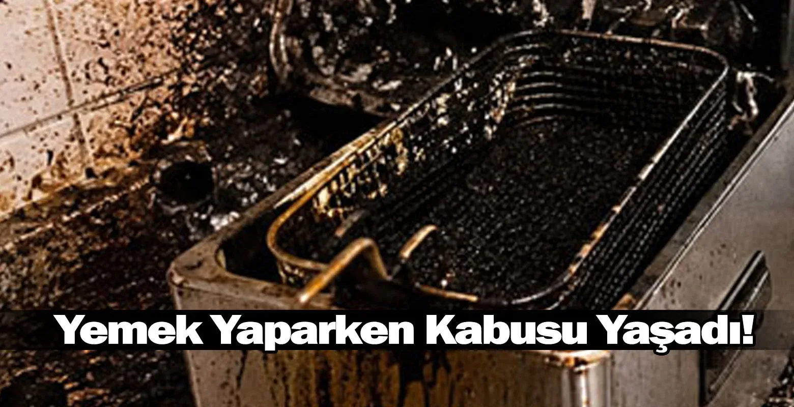 Yemek Yaparken Kabusu Yaşadı!