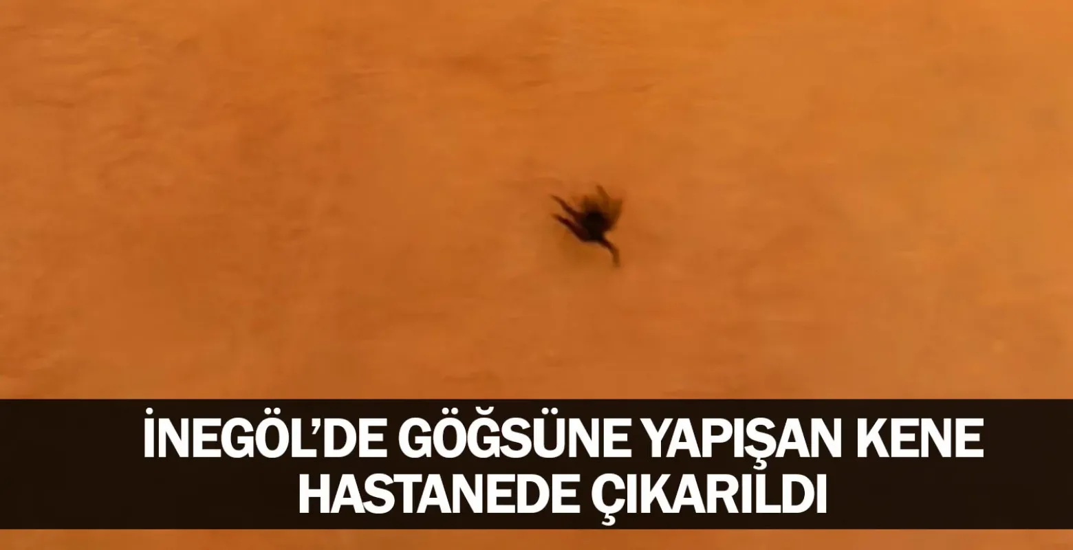 Göğsüne yapışan kene hastanede çıkarıldı