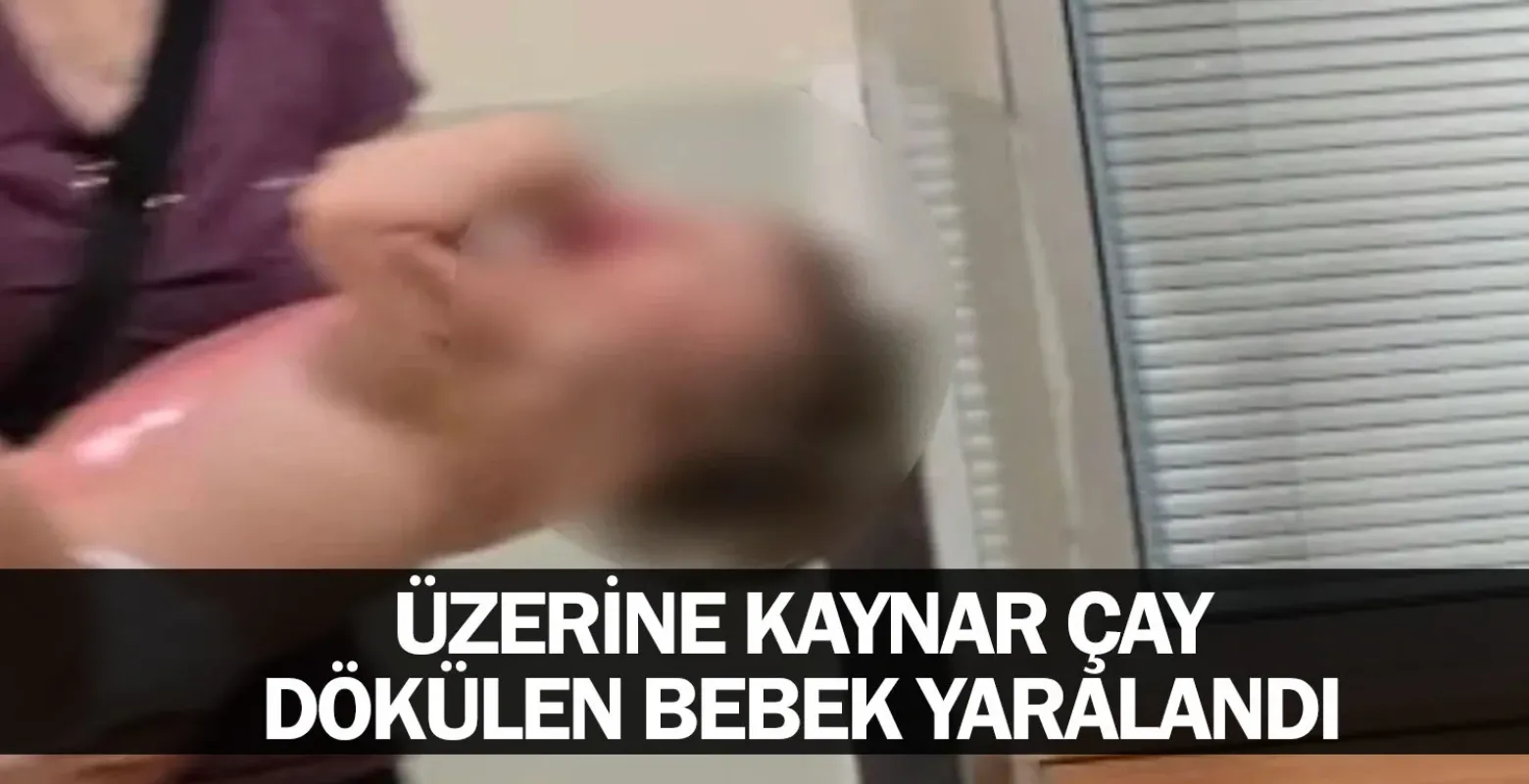 İnegöl'de üzücü olay:Üzerine kaynar çay dökülen bebek yaralandı