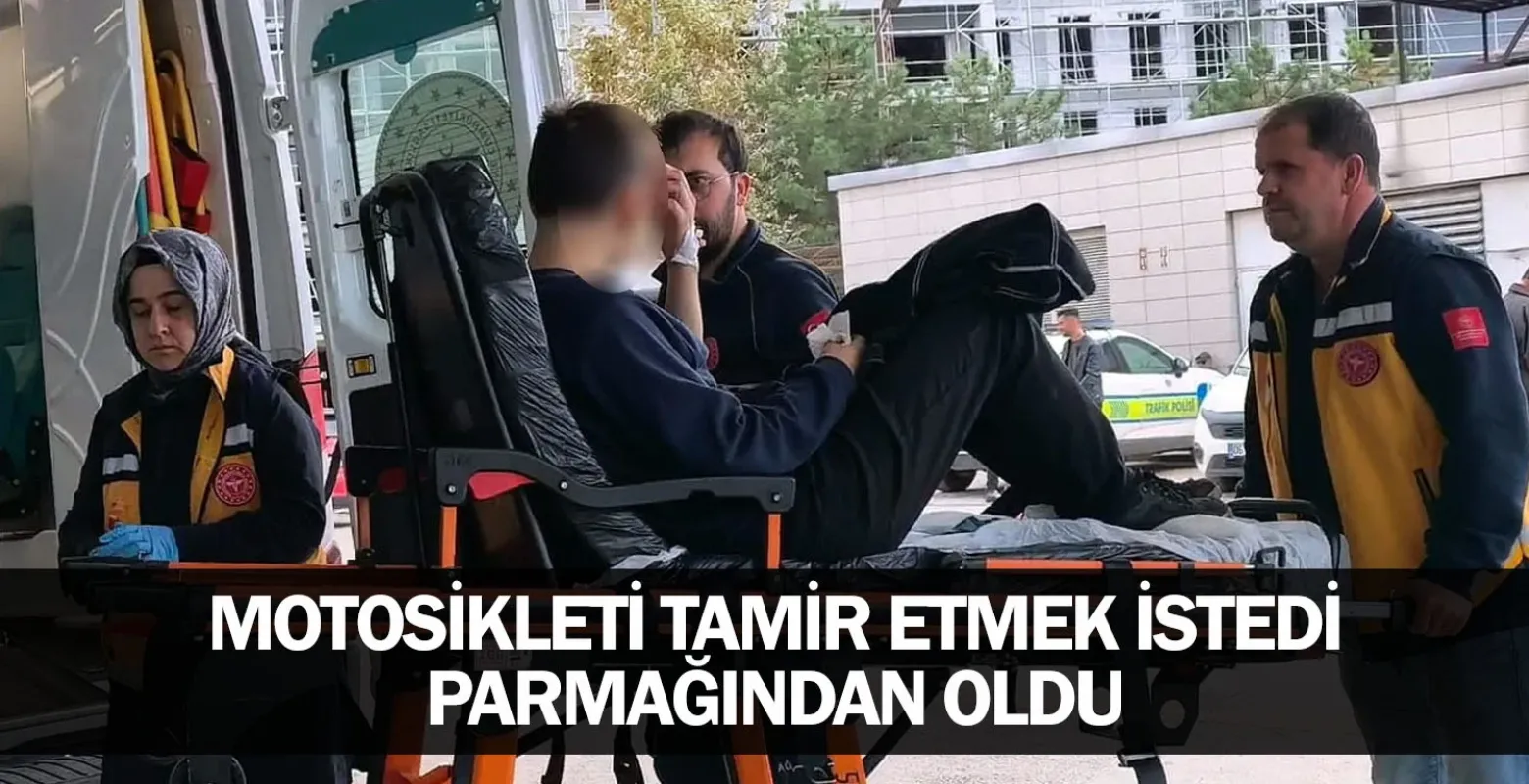Motosikleti Tamir Etmek İstedi, Parmağından Oldu