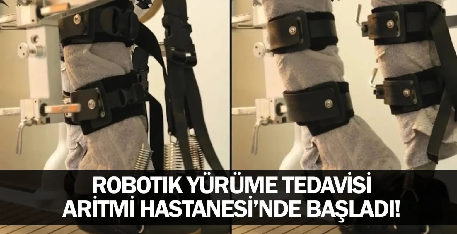 İnegöl’de Sağlıkta Dev Adım: Robotik Yürüme Tedavisi Aritmi Hastanesi’nde Başladı!