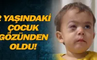 2 yaşındaki çocuk gözünden oldu