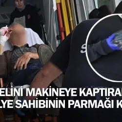 Elini makineye kaptıran atölye sahibinin parmağı koptu
