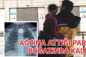 İnegöl'de ağzına attığı para boğazında kaldı