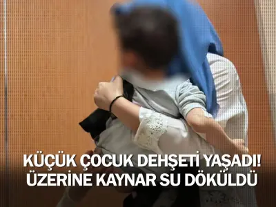 Küçük çocuk dehşeti yaşadı! Üzerine kaynar su döküldü ...