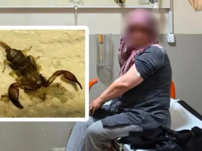 İnegöl'de akrep hastanelik etti!