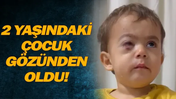2 yaşındaki çocuk gözünden oldu