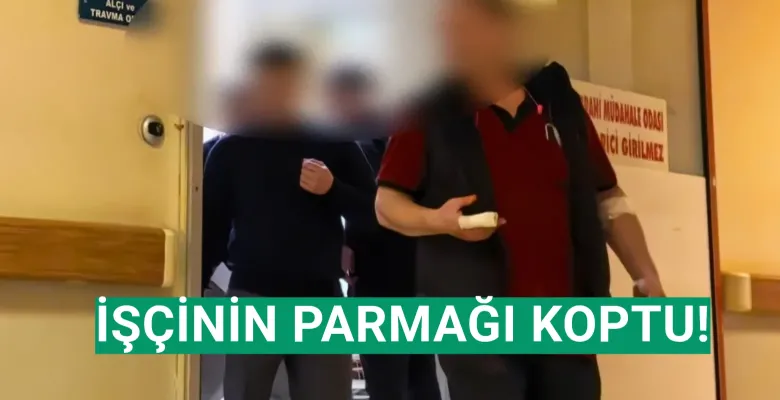 İşçinin parmağı koptu!