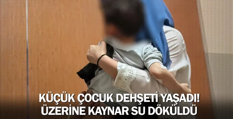 Küçük çocuk dehşeti yaşadı! Üzerine kaynar su döküldü ...