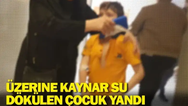 Üzerine kaynar su dökülen çocuk yandı