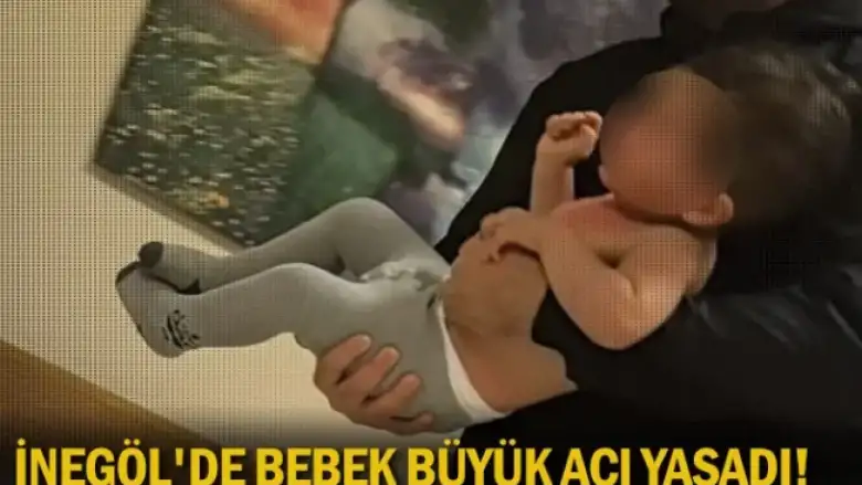 İnegöl'de bebek büyük acı yaşadı!