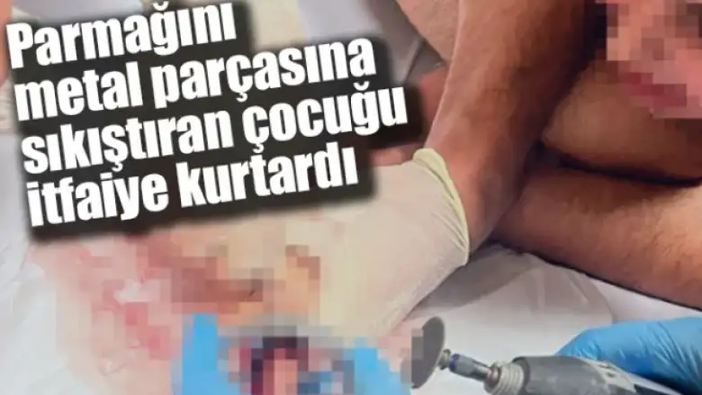 Parmağını metal parçasına sıkıştıran çocuğu itfaiye kurtardı