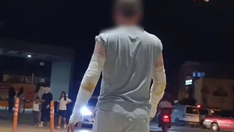 Her şey bir anda oldu! Çalışırken hayatının şokunu yaşadı